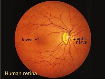 normal retina (from: University of Utah)